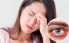 Đau hốc mắt cảnh báo bệnh gì?