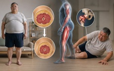 Béo phì thiểu cơ khiến người già dễ ngã, gãy xương