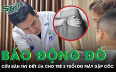 Báo động đỏ cứu bàn tay đứt lìa cho trẻ 2 tuổi bị máy dập cốc cuốn vào