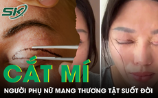 Tin lời 'chuyên gia' thẩm mỹ, người phụ nữ nhận kết cục đau đớn sau cắt mí mắt