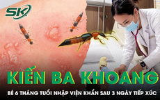 Bé 6 tháng tuổi nhập viện sau tiếp xúc kiến ba khoang, bác sĩ chỉ dấu hiệu nguy hiểm