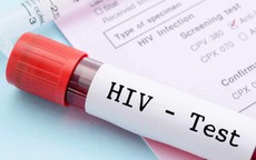 Sau quan hệ tình dục không an toàn bao lâu thì nên xét nghiệm HIV?