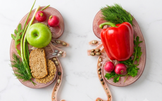 3 bí quyết ăn uống đơn giản giúp ngăn ngừa sỏi thận