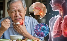 Những bài tập cơ vùng cổ họng cho người lớn tuổi có dấu hiệu khó nuốt