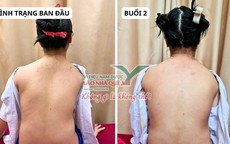 Tìm hiểu nguyên lý 'Khai thông cột sống' của Lão Nhà Quê