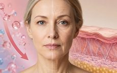 Sau mãn kinh: Vì sao da lão hóa nhanh trong những năm đầu?