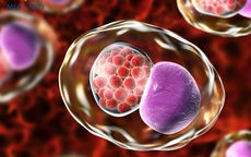 5 dấu hiệu cảnh báo nhiễm Chlamydia ở phụ nữ: Nhận biết sớm để phòng ngừa vô sinh