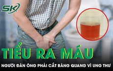 Chủ quan tiểu ra máu nhiều năm, người đàn ông phải cắt bàng quang vì ung thư