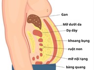 Mỡ nội tạng nguy hiểm hơn mỡ dưới da như thế nào?
