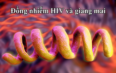Đồng nhiễm HIV và giang mai: Tầm soát định kỳ để ngăn chặn biến chứng tổn thương thần kinh