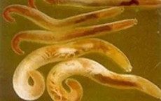 Phát hiện 2 lượt dương tính với giun đầu gai ở Khánh Hòa, bác sĩ cảnh báo nguy cơ từ món ăn khoái khẩu