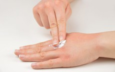 Viêm da tiếp xúc phải làm gì để nhanh khỏi?