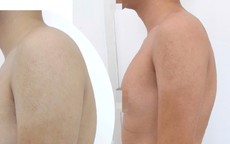 Cổ rụt, lưng gù vì ngồi học vẹo vọ, bò ra bàn