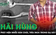Đau bụng âm ỉ, người đàn ông khiến bác sĩ sốc khi trong dạ dày có nhiều bàn chải và thìa inox