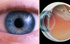 Mắt nhìn xa bị nhòe là biểu hiện của bệnh gì?