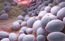 Đau rát vùng miệng, lưỡi kéo dài cảnh giác với nấm miệng họng do Candida