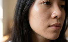 6 sai lầm khi chăm sóc da dầu khiến da càng đổ dầu