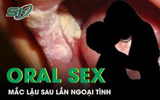 Mắc bệnh lậu sau lần ngoại tình với bạn gái mới quen, người đàn ông hối hận vì chủ quan oral sex