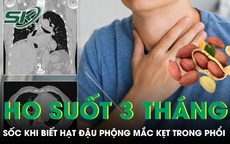 Ho suốt 3 tháng, người đàn ông sốc khi bác sĩ gắp ra hạt đậu phộng mắc kẹt trong phổi