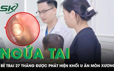 Bé trai 27 tháng tuổi liên tục gãi tai bác sĩ phát hiện khối u ăn mòn xương tai 