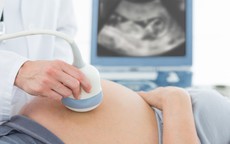 Tắc mạch ối ở sản phụ hiếm gặp nhưng nguy hiểm 