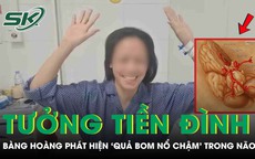 Đau đầu tưởng tiền đình, người phụ nữ bàng hoàng phát hiện “quả bom nổ chậm” trong não