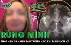 Rùng mình: Cô gái tá hỏa phát hiện 38 nang sán trong não