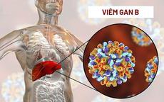 Viêm gan B cần kiêng gì để phòng biến chứng?