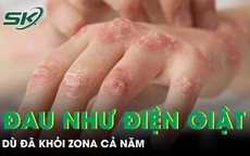 Khỏi zona cả năm vẫn bị những cơn đau như điện giật hành hạ 