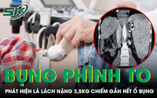 Bụng phình to không đại tiện được, bàng hoàng phát hiện lá lách nặng 3,5kg
