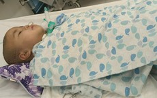 Bé gái 3 tuổi trải qua 6 ca phẫu thuật vì xuất huyết não, phía trước còn ca ghép sọ cần sự trợ giúp