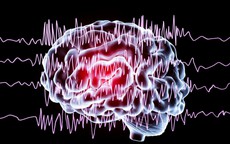 Động kinh ở trẻ em có chữa khỏi được không?