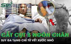 Người đàn ông suy đa tạng, phải cắt cụt 5 ngón chân chỉ từ vết xước nhỏ
