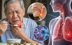 3 bệnh thường gặp ở người cao tuổi khi giao mùa