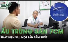 Tắm suối một lần, người đàn ông 40 tuổi phát hiện ấu trùng sán dài 7cm