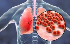 Viêm phổi ở người già có lây không?