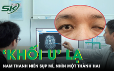 Nam thanh niên sụp mí, nhìn một thành hai vì 'khối u' lạ