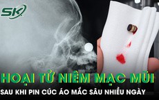Bé trai 4 tuổi hoại tử niêm mạc mũi vì pin cúc áo mắc sâu nhiều ngày