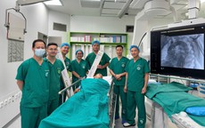 Đặt stent graft cứu bệnh nhân phình động mạch chủ ngực khổng lồ đến 89mm