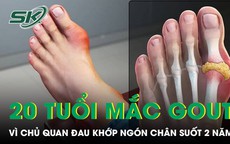 Đau khớp ngón chân suốt 2 năm nam thanh niên 20 tuổi mắc gout