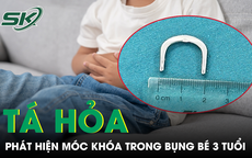 Tá hỏa phát hiện chiếc móc khóa hình chữ C trong bụng bé 3 tuổi