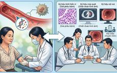 Xét nghiệm ctDNA có quyết định việc hóa trị sau mổ ung thư đại tràng?