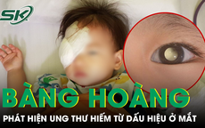 Bàng hoàng phát hiện trẻ mắc ung thư hiếm gặp từ dấu hiệu ở mắt