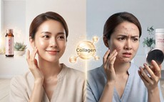 Bổ sung collagen có bị nổi mụn?