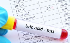 7 lưu ý khi tầm soát acid uric