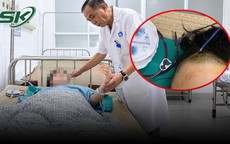 Bé gái 9 tuổi ngã xe đạp phải mở sọ cấp cứu 
