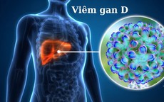 HIV và viêm gan D mạn tính: Vì sao cần đặc biệt lưu ý?