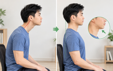 'Cổ rùa' do dùng điện thoại: 4 bài tập giúp cải thiện tư thế