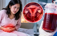 Chậm kinh 10 ngày, người phụ nữ 31 tuổi chảy hơn 600 ml máu trong ổ bụng