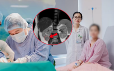 Phát hiện khối u hiếm gặp từ dấu hiệu tăng huyết áp trong thai kỳ